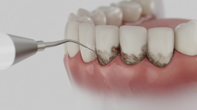 Trusted Invisalign Clear Aligners service in Scott AFB, IL - Dentist Open Now
